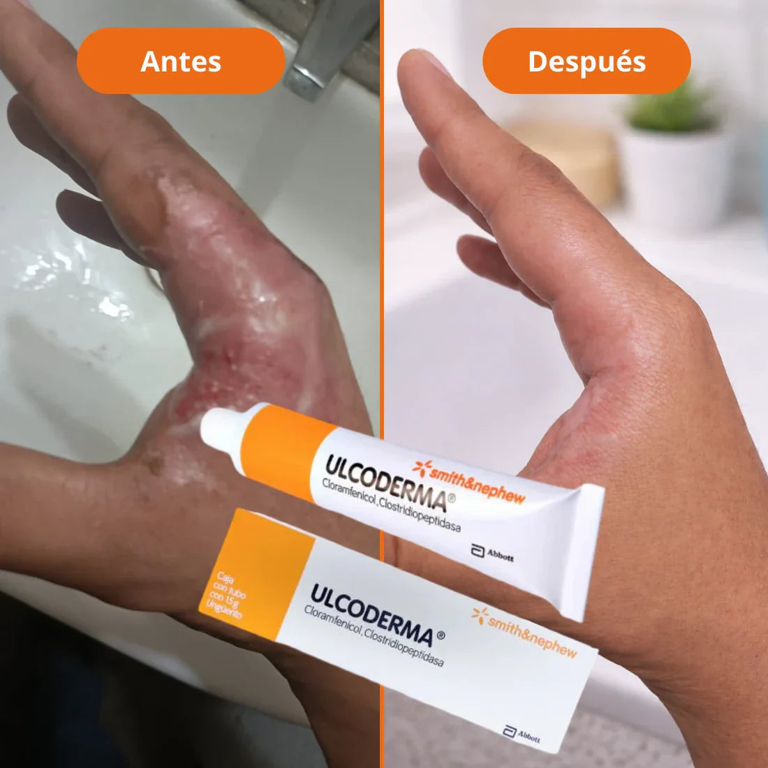 ULCODERMA UNGÜENTO 30grs